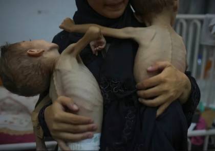 17 مؤسسة حقوقية تُكذب ويتكوف: أدلة مجاعة غزة ملموسة ولا تُمحى بالتصريحات
